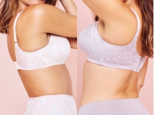 Best Bras For Back and SIde Fat.