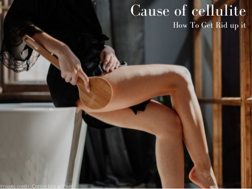 What is Cellulite? Its Cause and How to get a rid of.