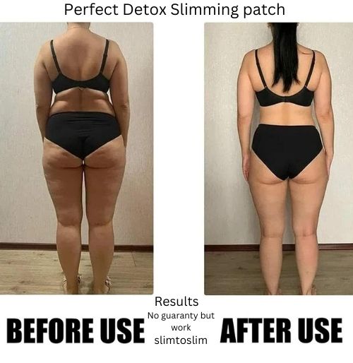 Result Before and After of Perfect Slimming Detox Patch
